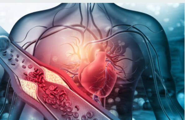 Colesterol alto: causas, mitos y cómo controlarlo con hábitos saludables en Houston